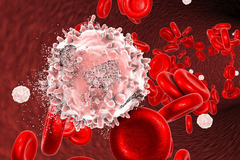 Leukemia & Lymphoma Society Changing Name to Blood Cancer United