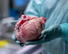 First U.S. Trial Explores Pig Kidneys for Human Transplants