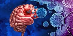 Traces Of Bacteria Found In Brain Tumors
